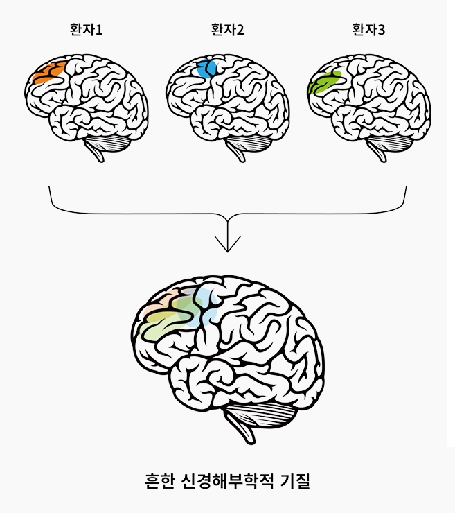 뇌파 비교 이미지