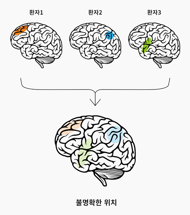 뇌파 비교 이미지